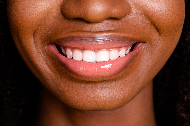 Cosmetic Gum Surgery in Grosse Pointe Woods