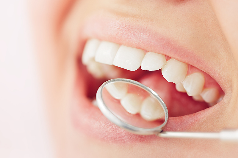Dental Inlays And Onlays in Grosse Pointe Woods